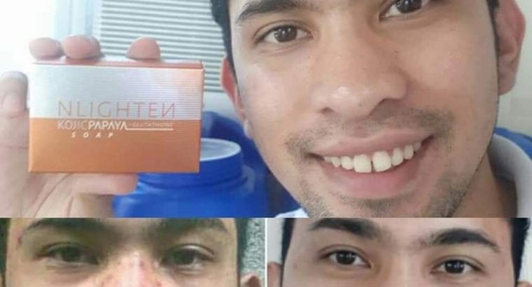 Kojic Papaya with Glutathione