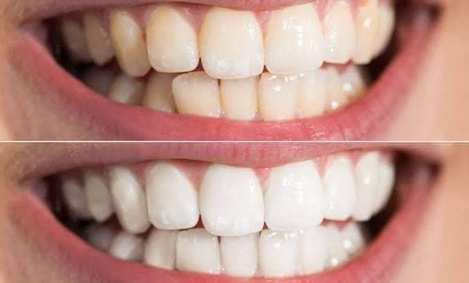 Nlighten toothpaste